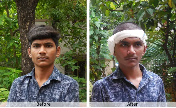 Sanket’s Journey